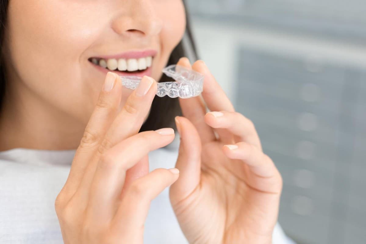 Braces or Clear Aligners? A Guide for Meriden, CT Patients