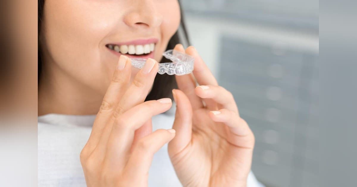 Clear Braces vs. Metal Braces: Key Differences Explained